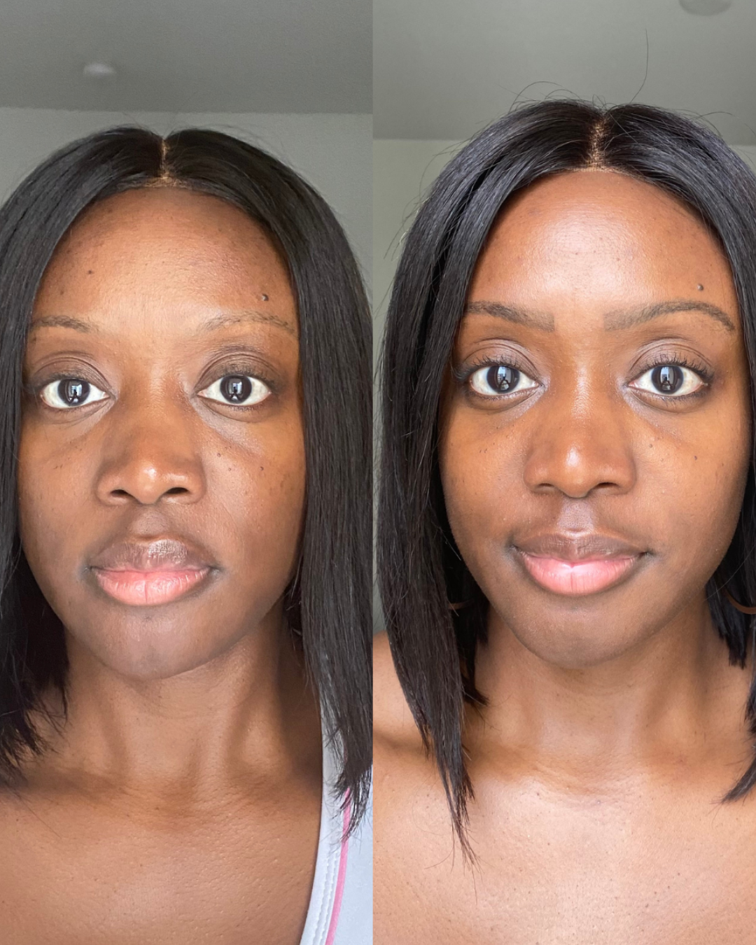 Before and after 30-day results using Adapto Beauty Barrier Support Dream Cream, showing improved hydration, smoother skin, and reduced redness and fine lines